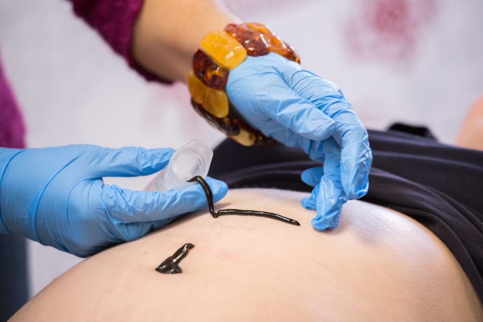 Instytut Hirudologii Sanus